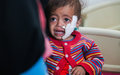 Yemen: Dos años en conflicto y al borde de la catástrofe