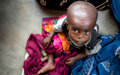Unos 7,7 millones de personas sufren hambre en la República Democrática del Congo